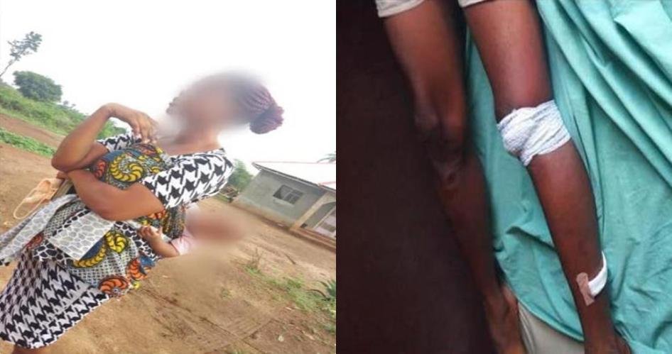 Father Cuts Off Man’s Leg For Defiling His 6-Month-Old Baby (Photos)