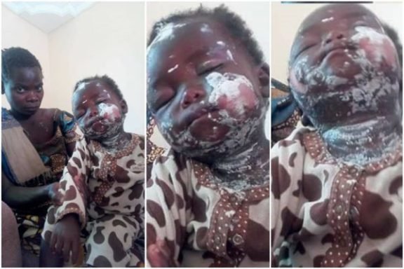 Landlady pours hot porridge on tenant’s 1-year old baby over unpaid rent