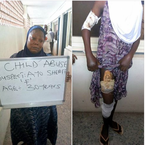 Woman Arrested For Burning Her Own Daughter With Electric Iron. Photos