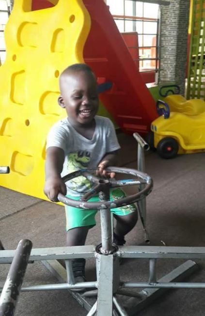 See Graphic Photo Of Boy Who Fell Inside Pot Of Boiling Water Few Days To His Birthday In Bayelsa