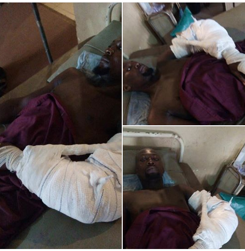 Man Allegedly Attacked By Fulani Herdsmen In Enugu, Hand Gets Chopped Off [Photos]