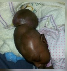 Ede Poly Student Gave Birth To This Strange Baby, Calls On Community For Help (SEE PHOTOS)