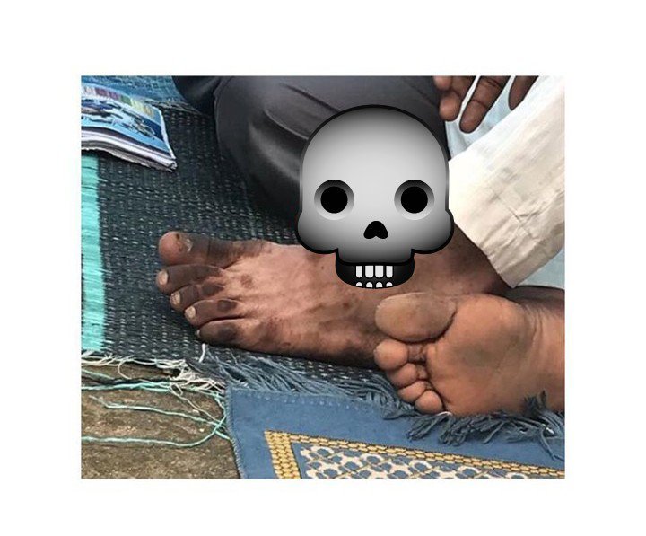 Man causes distraction with his shocking Leg during Jumat prayer today (Photo)