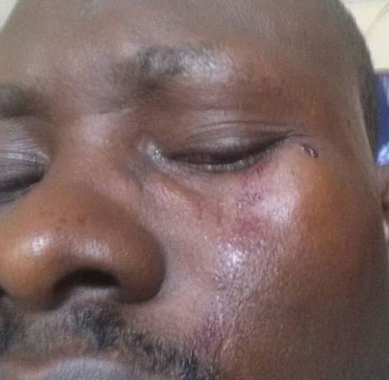 Man Cries Out After Davido’s Boys Beat him to Pulp, For Driving in their Front in Lekki (See Photos)