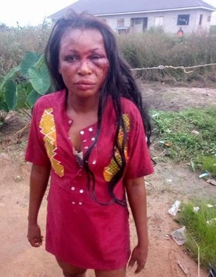 Man Batters His Wife, Scatters her Face with Blows For Crying of Hunger This Morning in PH (Photos)