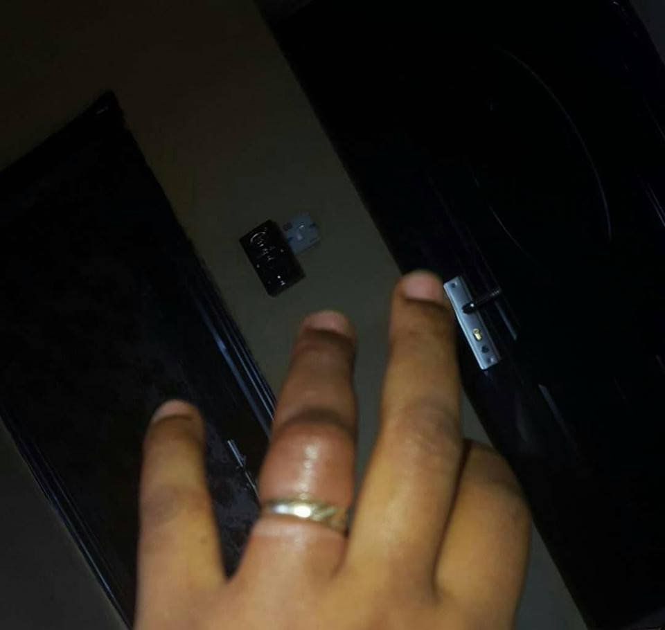 Married Woman’s Finger Set to be Cut off, As her Wedding Ring Refuses to remove (Photos)