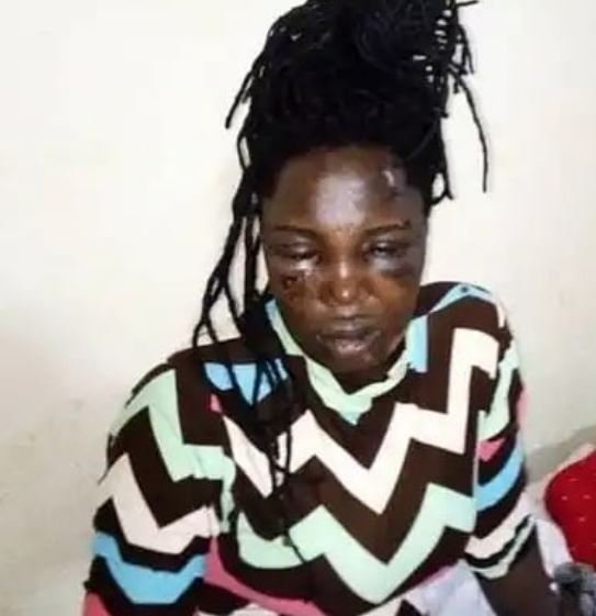 Pretty Lady Cuts off her Boyfriend’s Manh0od After Neighbors Said he Cheats on her (Photos)