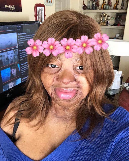 Plane Crash Survivor Kechi Shares Throwback Photos to Mark her Birthday, See How She Used to Look