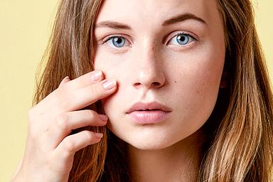 Easy Quick Acne Home Remedies