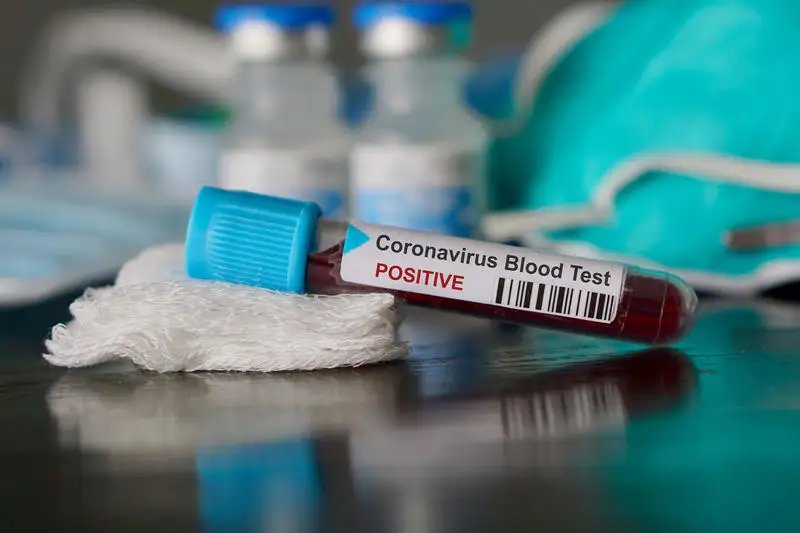 WHO official, two others test positive for Coronavirus in Bauchi