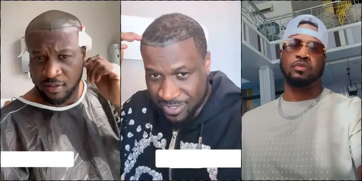 Peter Okoye Shares His Hair Transplant Journey in Turkey